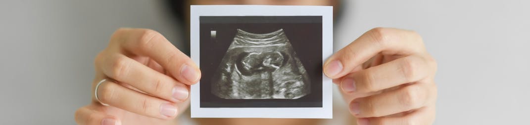 A woman holding up a sonogram picture to the camera.