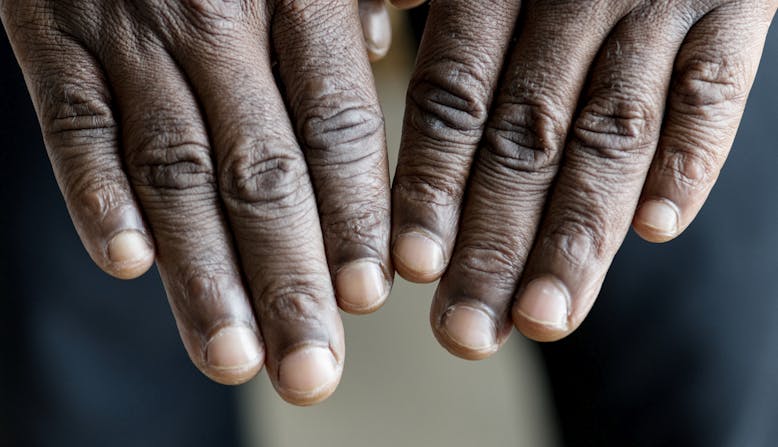 A person sticking their hands out, showing their fingernails. 