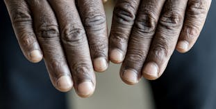 A person sticking their hands out, showing their fingernails.