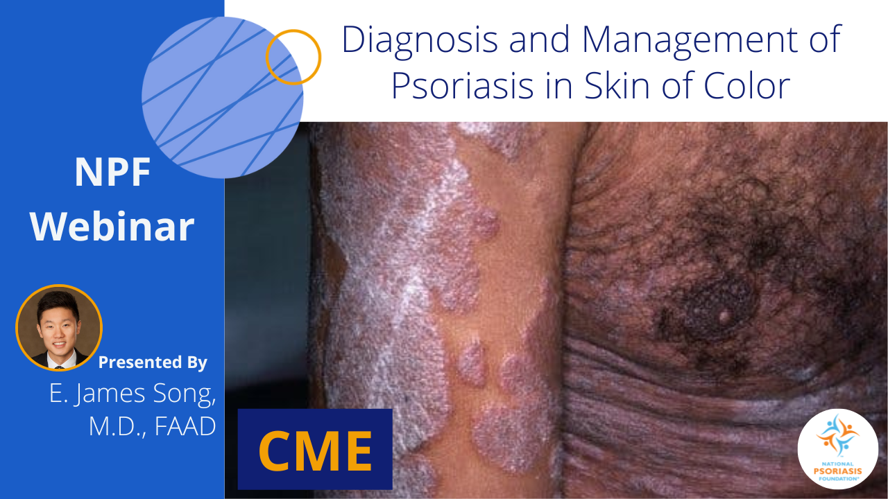 NPF Webinar: Diagnosis and Management of Psoriasis in Skin of Color Presented by E. James Song, M.D.