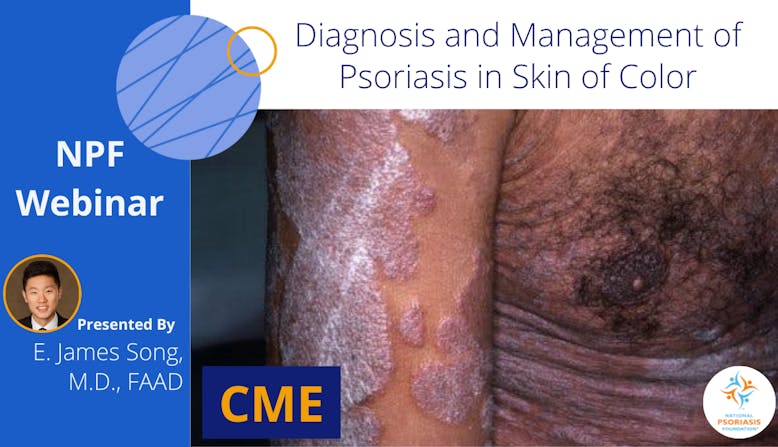 NPF Webinar: Diagnosis and Management of Psoriasis in Skin of Color Presented by E. James Song, M.D.
