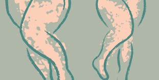 An illustration of two pairs of legs with splotches to represent psoriasis.