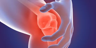 Illustrated knee pain to represent psoriatic arthritis. 