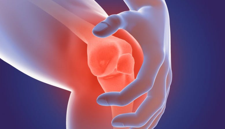 Illustrated knee pain to represent psoriatic arthritis.