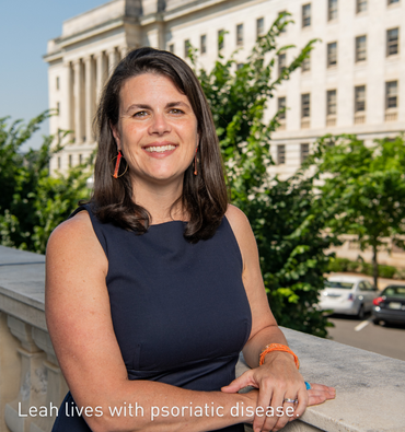 NHC Board Member Leah Howard lives with psoriatic disease.