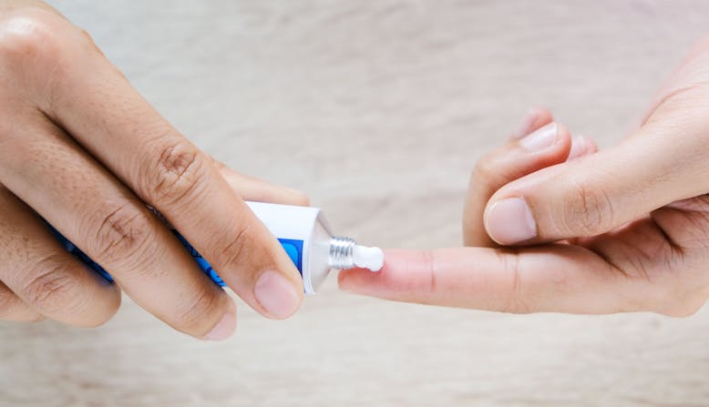 A person puts a topical treatment from a tube onto their finger.