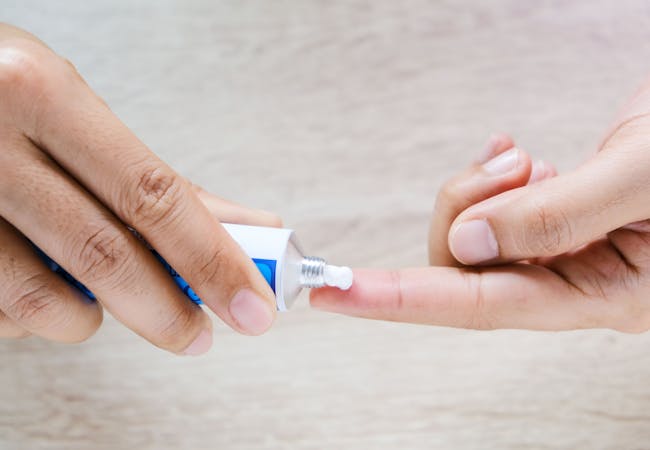 A person puts a topical treatment from a tube onto their finger.