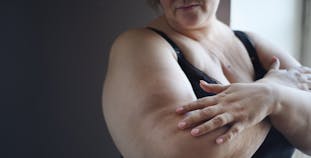 An obese woman looks at her arm while touching it with her other hand.