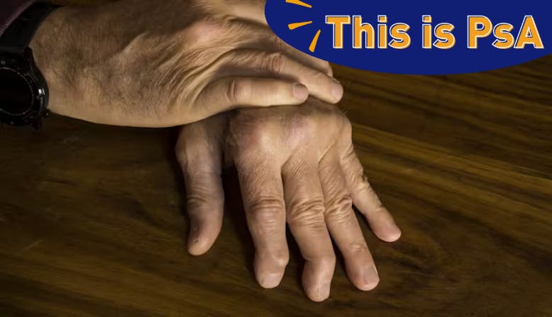 A person's hands show the effects of psoriatic arthritis. This is PsA - PsA Action Month 2024