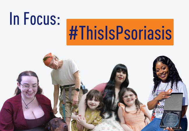 In Focus: #ThisIsPsoriasis with Jordan, Matt, Kaitlin, and Takieyah