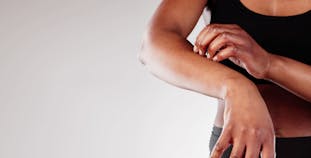 A black woman is shown from the shoulders down scratching at her itchy arm.