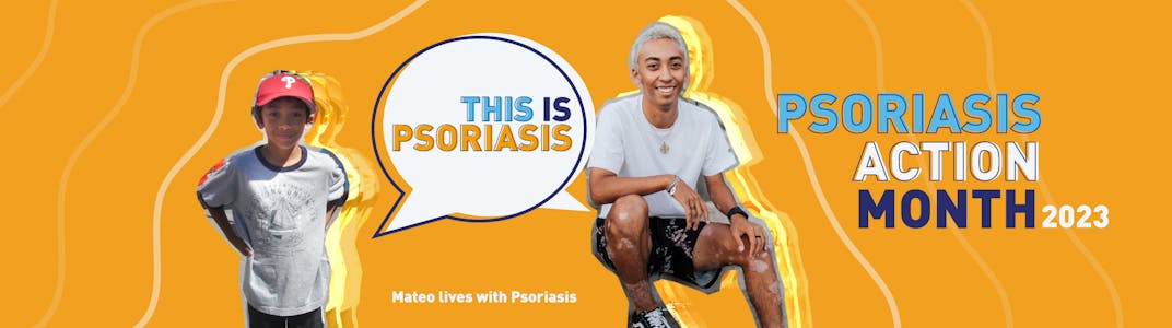 #ThisIsPsoriasis - Psoriasis Action Month 2023 - Mateo lives with Psoriasis