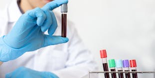 A medical professional holds a vial of blood.