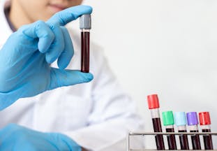 A medical professional holds a vial of blood.