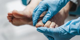 A doctor looks at a patient's toenails.