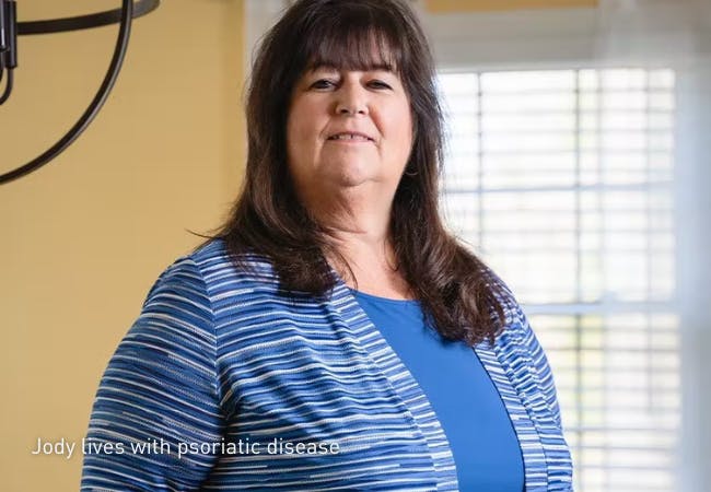 Jody lives with psoriatic disease.