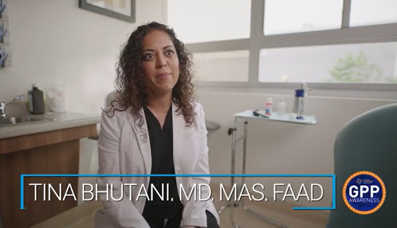 Dr. Tina Bhutani in the Generalized Pustular Psoriasis Videos