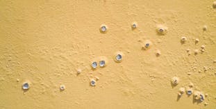 Paint bubbles and peeling. Generalized Pustular Psoriasis concept.