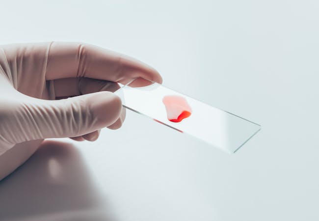 A blood sample on a slide.