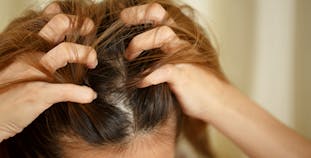 A woman scratches her itchy head.