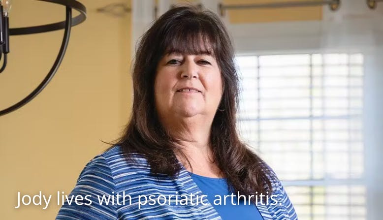 Jody lives with psoriatic arthritis.