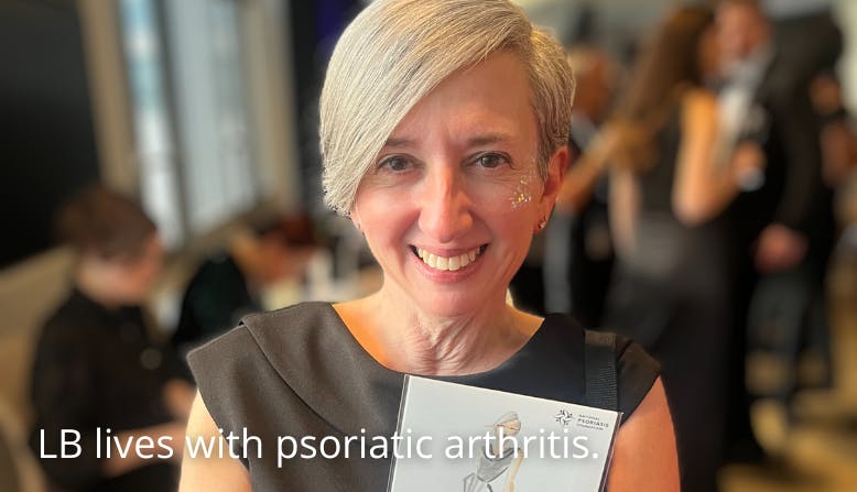 LB lives with psoriatic arthritis.