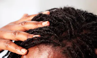 A Black woman touches her hair and scalp.