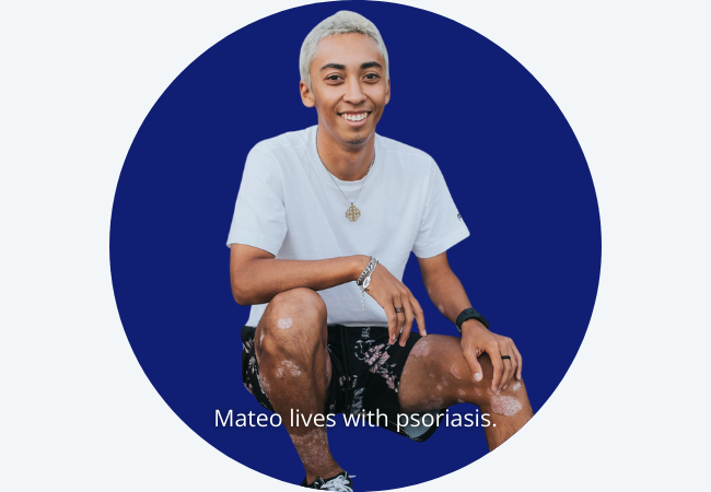 Mateo lives with psoriasis.