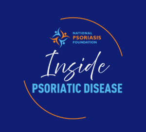 Inside Psoriatic Disease