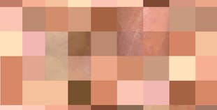 A patchwork of various skin tones with photos of psoriasis on skin of color underlaid.