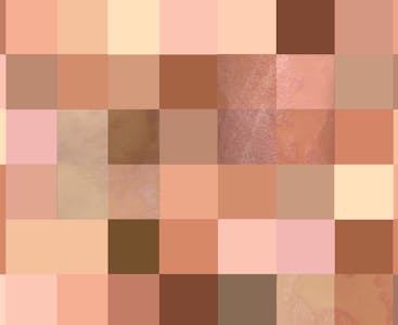 A patchwork of various skin tones with photos of psoriasis on skin of color underlaid.
