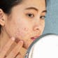 You Asian woman with visible acne on her face looking into a mirror and touching her face.