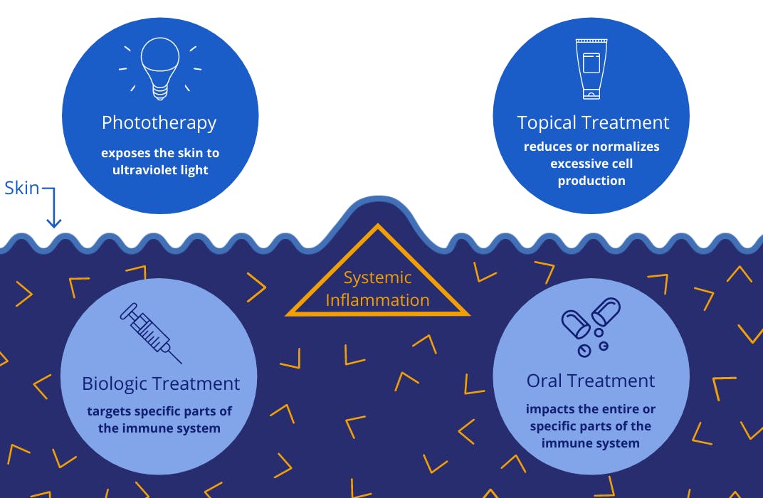 Graphic of treatment options - includes phototherapy, topical treatments, biologic treatments and oral treatments.