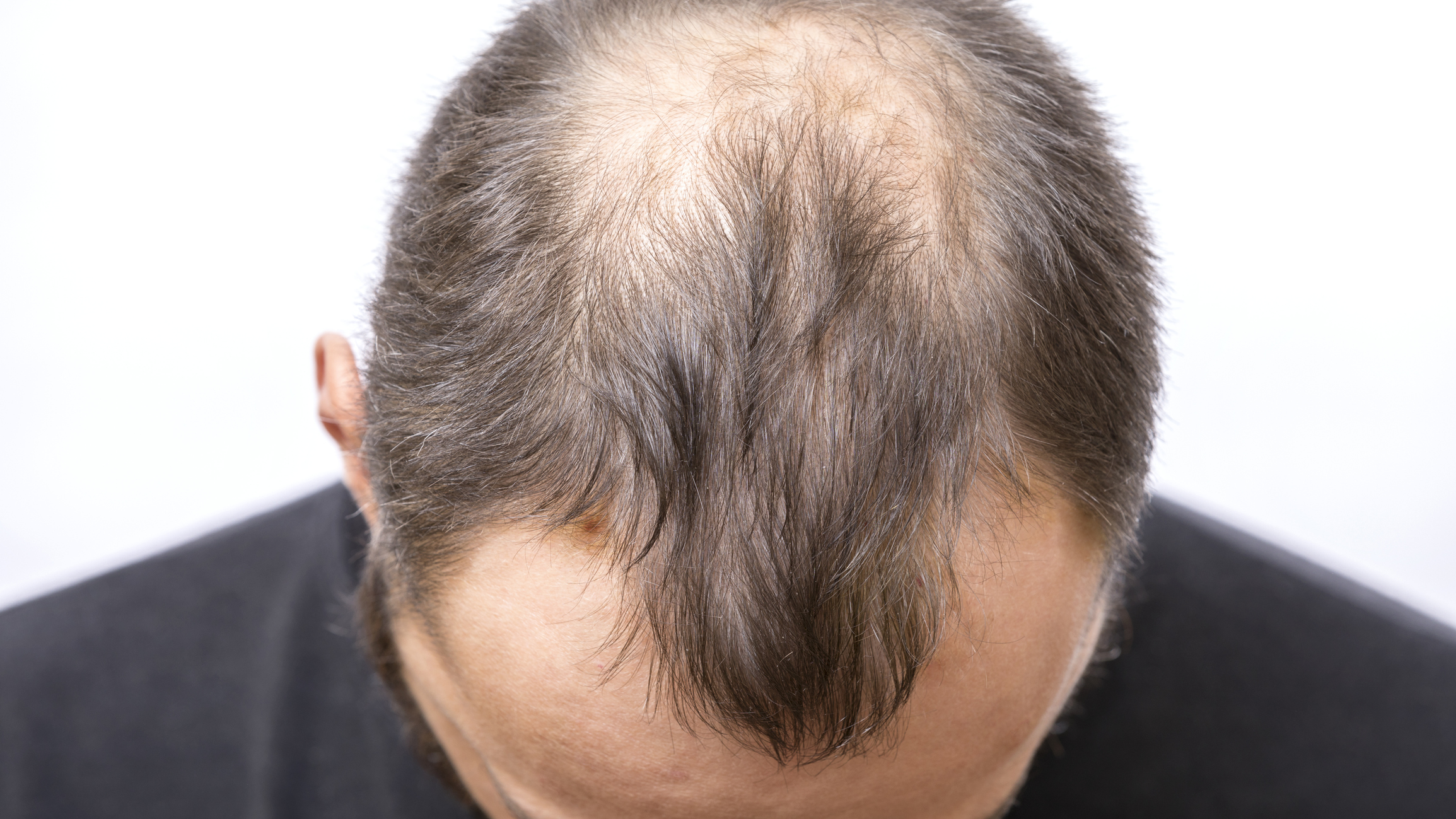 REGAINE® for Men Hair Loss Solution | REGAINE® UK
