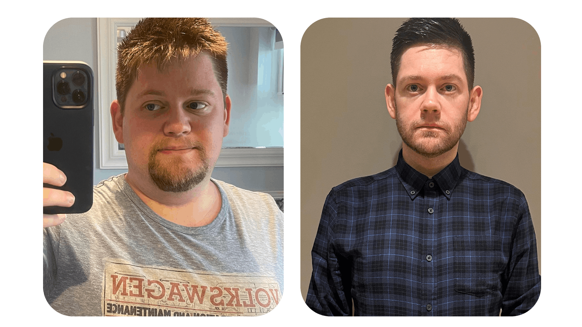 Mike's Story, Weight Loss Patient Stories