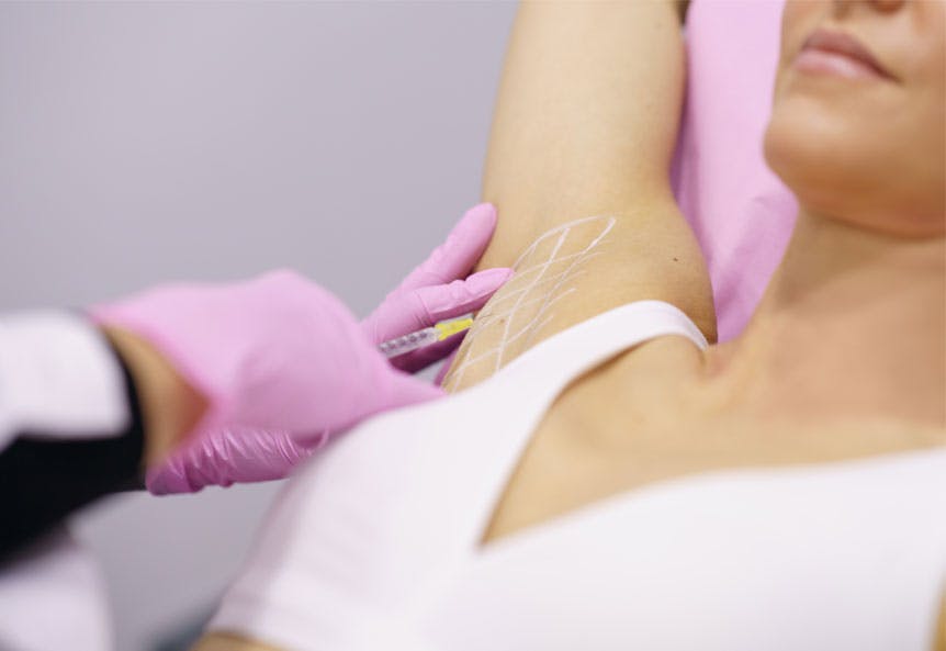 Girl receiving botox for hyperhidrosis