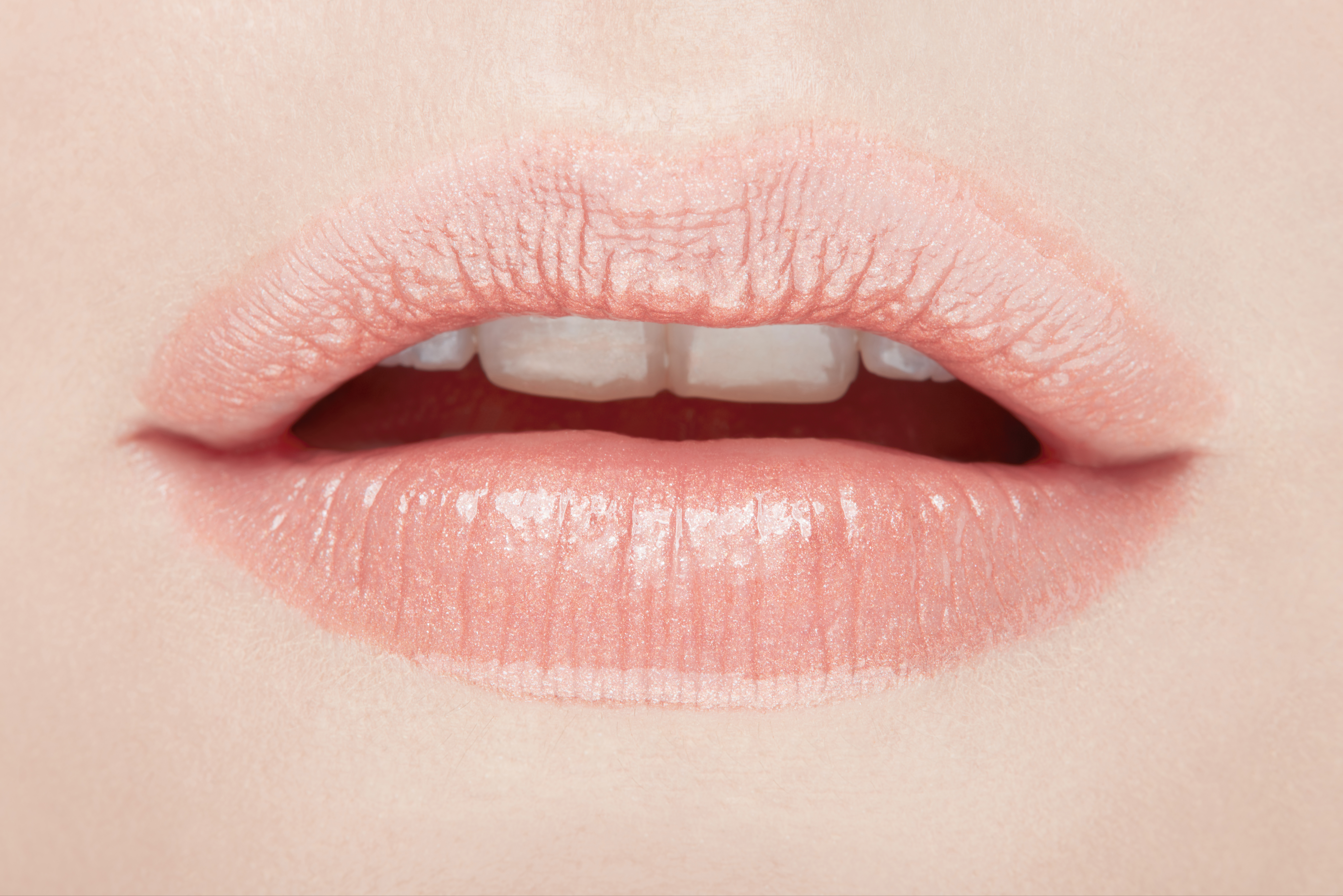 subtle lip enhancement with botox lip flip