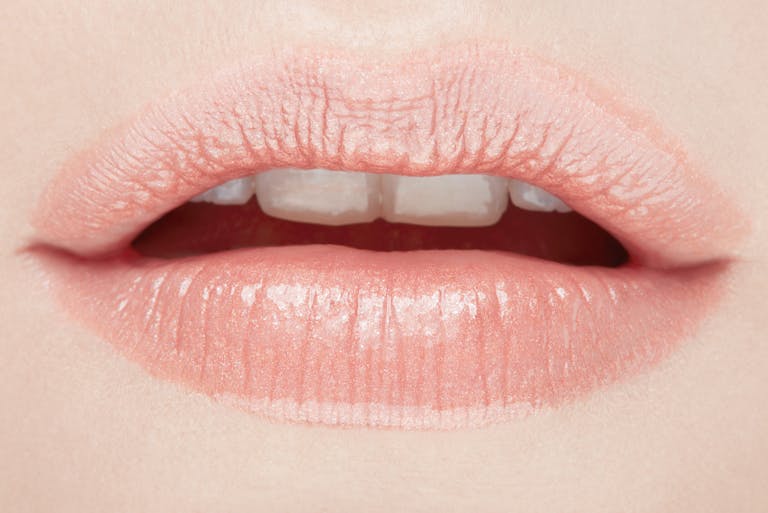 subtle lip enhancement with botox lip flip