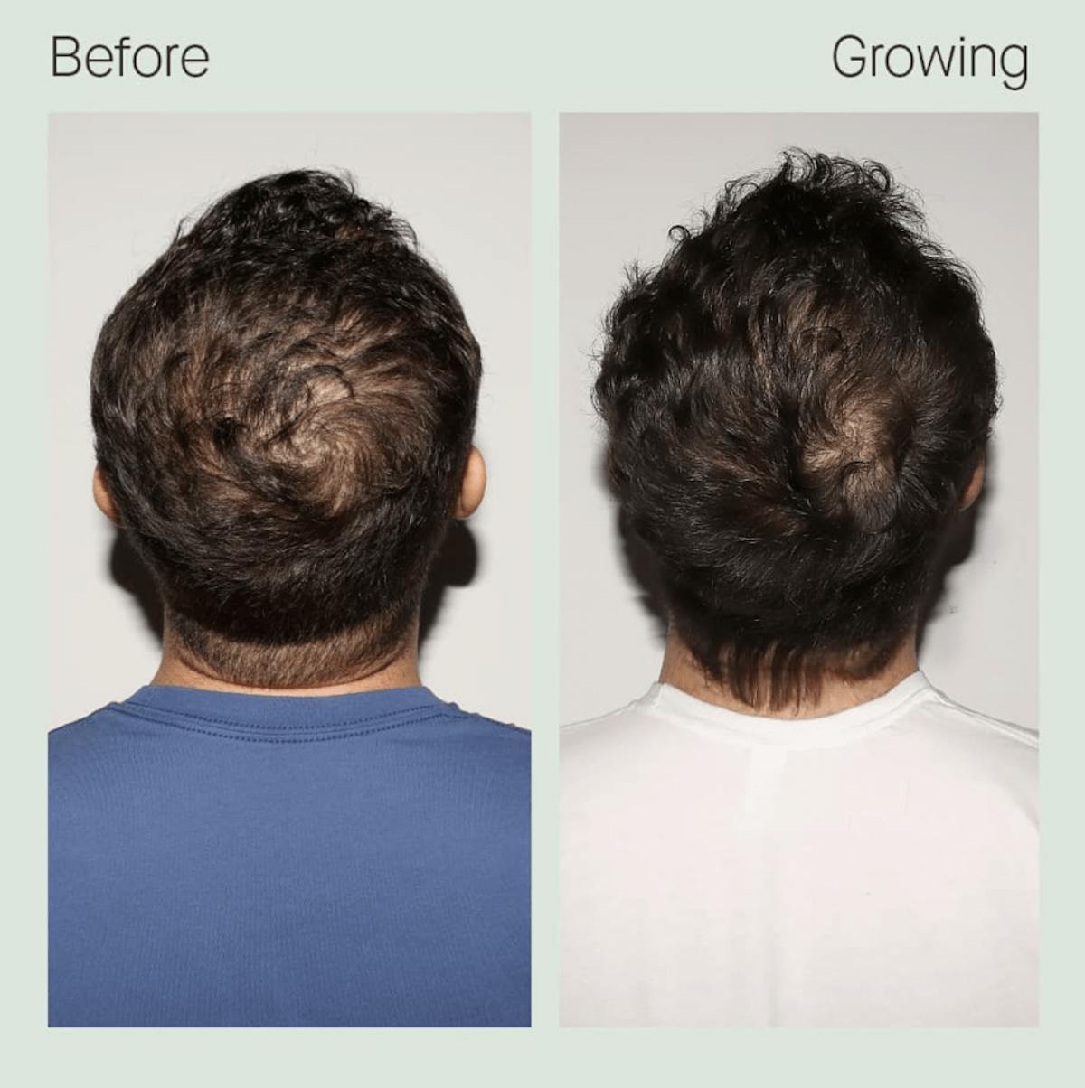 These Men Transformed Their Hair With Nutrafol Nutrafol