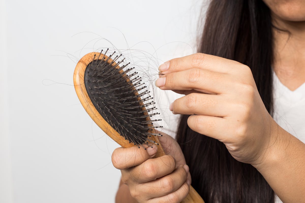 Dandruff Hair Loss: Causes & How To Stop It | Nutrafol