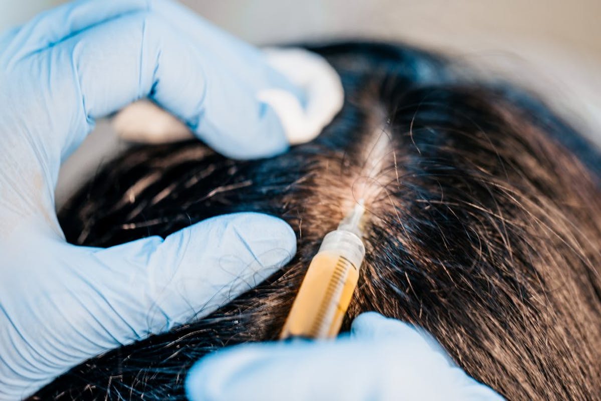 6 CuttingEdge Hair Growth Treatments For 2020 Nutrafol