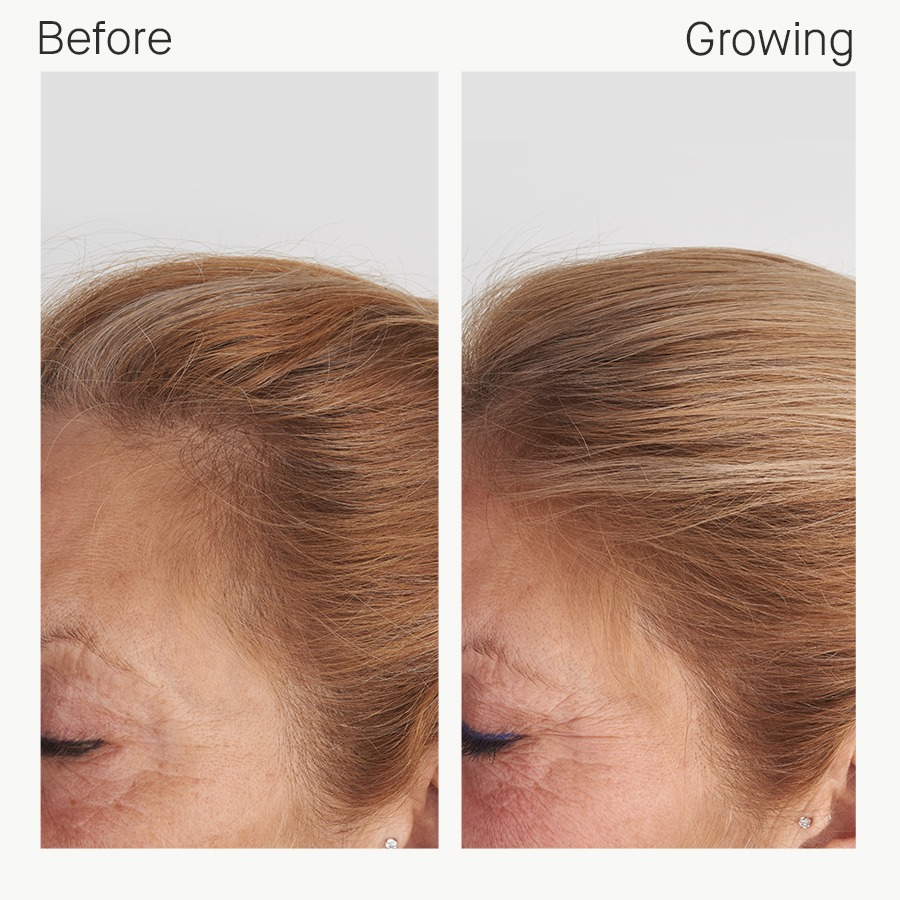 12 People Who Transformed Their Hair With Nutrafol Nutrafol