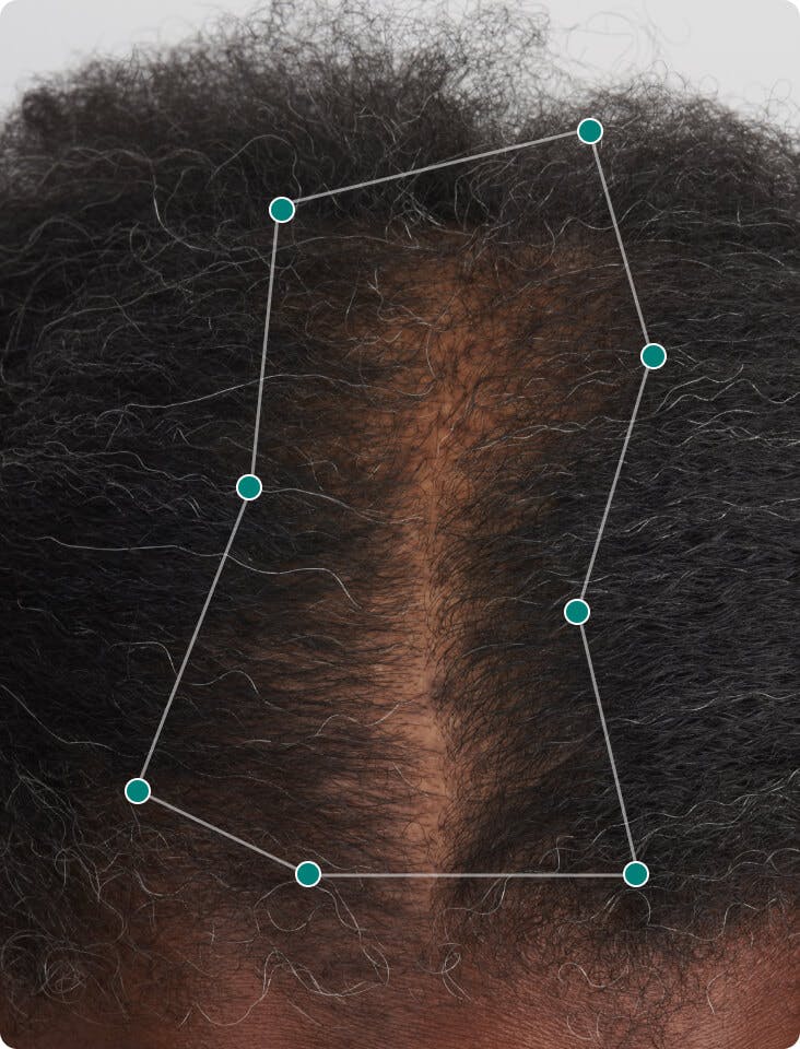 null before taking Women’s Balance Hair Growth Nutraceutical.