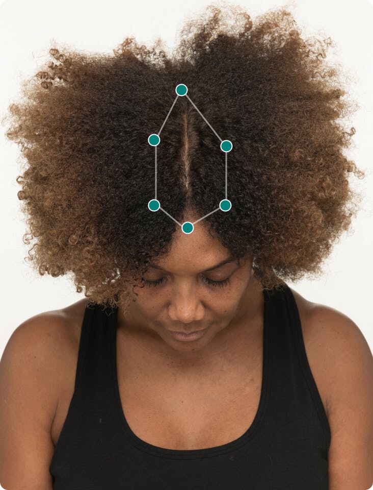 Kimberly 6 months into taking Women’s Balance Hair Growth Nutraceutical. Results may vary.