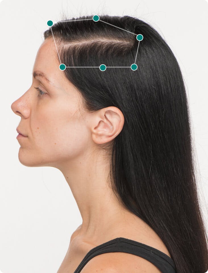 Cat 6 months into taking Women's Vegan Hair Growth Nutraceutical. Results may vary.