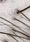 Extreme close-up of a clean, less oily, and less congested scalp after using Nutrafol Scalp Exfoliator.
