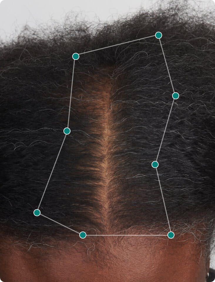 null 6 months into taking Women’s Balance Hair Growth Nutraceutical. Results may vary.