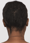 The back of a woman's head with short dark brown hair before using Strand Defender Conditioner.