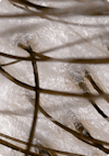 Extreme close-up of an oily, congested scalp.