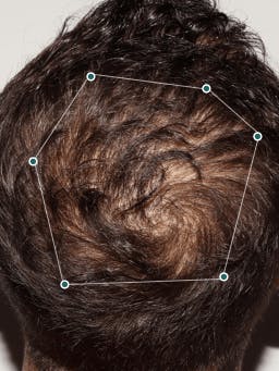 Hair Wellness from Within | Nutrafol Hair Wellness from Within | Nutrafol